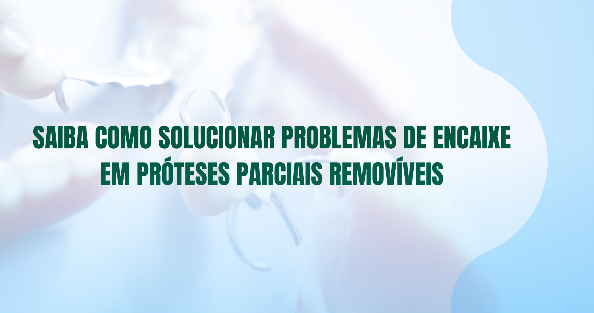 problema de encaixe em próteses parciais removíveis
